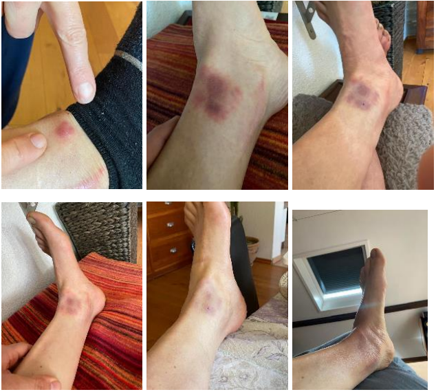 Ejemplo de Plasma en Acción